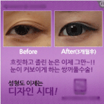 성형<b>수술</b>이화장인가