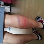 ★☆★☆ㅈ..ㅈ.제친구가...ㅅ..심각해요(사진有)★☆★☆