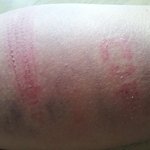 제 친구가 가정폭력을 당했어요 도와주세요(증거 사진 有)