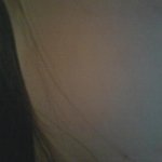 **(사진잇음)<b>좁쌀</b>여드름 극복후기**