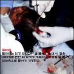 85-(혐)말파리<b>유충</b>
