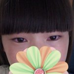 ★★★★★★★렌즈부작용의최후(사진有느님)★★★★★★★