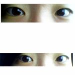 사진有) <b>쌍수</b>하면 이쁠까요????
