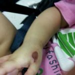 +수술후기+ <사진有>아이를 아프게 해 놓고 오리발 내미는 병원