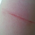 어떡해해야할까요??