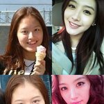 ●후기)사진有)성형이란거 볼수록 존1나무서운거네.●●