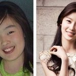 ★국제미인 9위? 성형을 고민하거나, 한사람들에대한 비판적인 글(스압주의)★