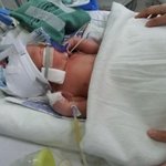 멀쩡한 아이 일찍 수술해서 미숙아를 만든 무지한 엄마입니다.