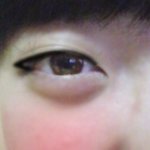 ★★★★★★애굣살관리법★★★★★★