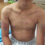 ★★★<사진, 동영상>학교폭력..학교&amp;경찰의 무시!!!! 제발도와주세요...