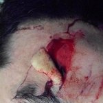 (사진有)군인에게 일방적인 폭행을 당했습니다. 심각합니다..도와주세요...