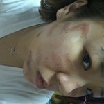 의료사고, 힘없는사람은 당하기만 해야하나요?