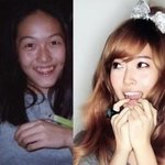 <b>치아</b> 교정 전 스타들의 모습