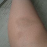 매일 동생에게 맞고 사는 누나