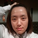 (사진有)20女 코성형+쌍수 <b>무료</b>이벤트당첨!!!!!!!!!!