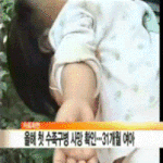 수족구병 사망 충격.. 수족구병에 좋은 음식은?