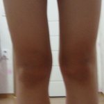 결심글) 15살 여중생 하체비만다이어트