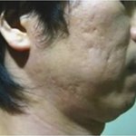 말도 안되는 피부 치료제??