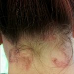 ㅇㅇ미용실에서 화상입혀놓고 대충넘어가려하네요