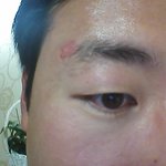 기적의 상처치유제?  바뀐  제 면상 공개합니다