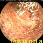 샤워하고 나와서 <b>면봉</b>으로 귀 닦아줘야 하는 이유