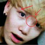 ▶▶▶▶▶bap 젤로 성형 증거◀◀◀◀◀