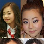 사진 有 <b>소희</b> 코 성형함?