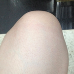 <b>반바지</b> 입고 쭈구려 앉으면 이렇게 되는거 저뿐?