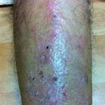 <b>수년</b>간 안 낫던 다리가 ~~