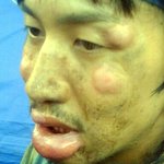 <b>이시각</b> 최대피해자......