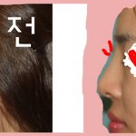 저 코좀 높아진것 같나요??!??! 꼭좀봐주세요ㅜㅜ