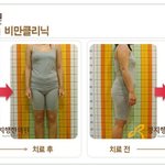 비만은 정신적 스트레스까지 <b>동반</b>한다!!