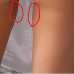 사진有) 허벅지 <b>안쪽</b>에 살이 희한하게..