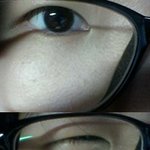 언니들ㅠㅠ제 눈 쌍수해야할거같나요..?ㅠㅠ(사진 有!!)