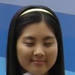 <b>서현</b> 얼굴에 일어난 무지막지한 변화..