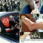 올림픽에만관심갖지마시고 여기도 관심가져주세요 국민이라면 이런세상에서...