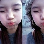 수지 쌍수증거사진有