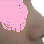 (수정)사진有코때문에 고민입니다.위로해주실분없나요?