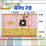 등과 가슴에 여드름이 많이 나요~