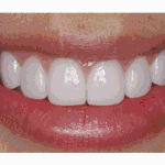 탑보다잘생기고원빈보다잘생긴이가탄