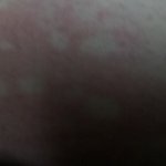 +두드러기사진) 충남 당x 뚜레x르 <b>케잌</b> 먹지마세요