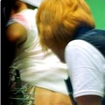 예전에 슈주 교통사고 났을때 이특 <b>흉터</b>
