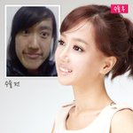 [<b>스크림</b>녀/페이스라인] 대륙의 <b>스크림</b>녀 강해균 페이스라인 수술했는데...