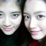 레인보우 김재경, 성형?