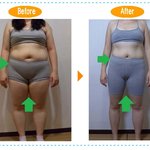 하체비만~ 이제는 당당하게 치마를 입자!!