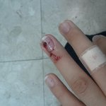 8/22 아침 선<b>바위</b>역 버스정류장에서 넘어진 남자분을 찾습니다.