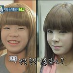 헐 눈 <b>코</b>만 했는데 이렇게 달라지다니 ...