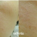 바이오 에센스! <b>Before</b> &amp; After 효과 실감기!