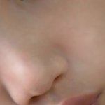 (추가)1위한 화장품이래서 썼는데...<b>치료비</b>140만원나옴