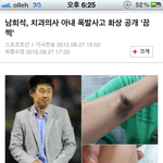 고데기가 <b>폭발</b>했어요
